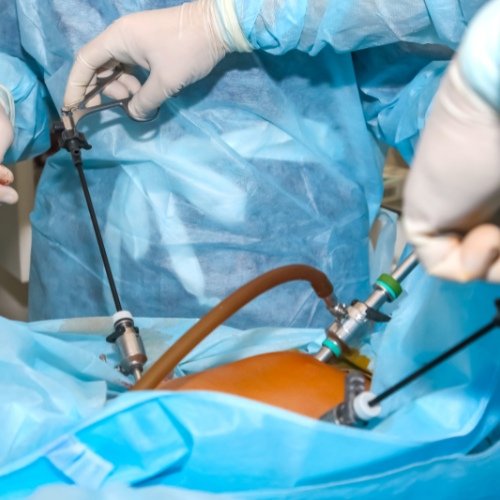 Laparoscopic Surgery in Sector 49 Gurgaon