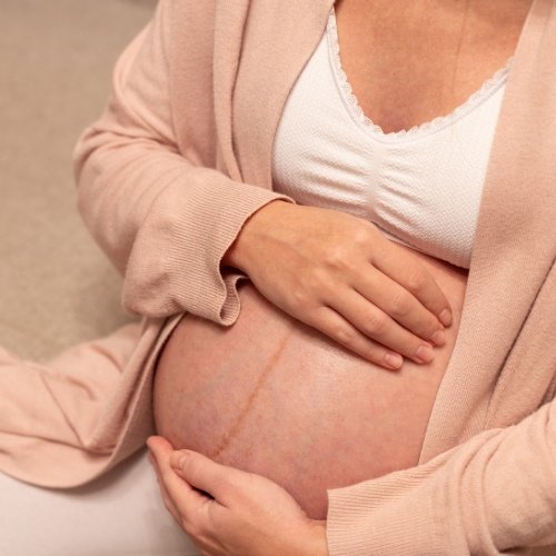 Normal Pregnancy & Childbirth Sector 49 Gurgaon