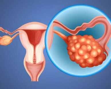 pcod treatment in sector 49 gurgaon