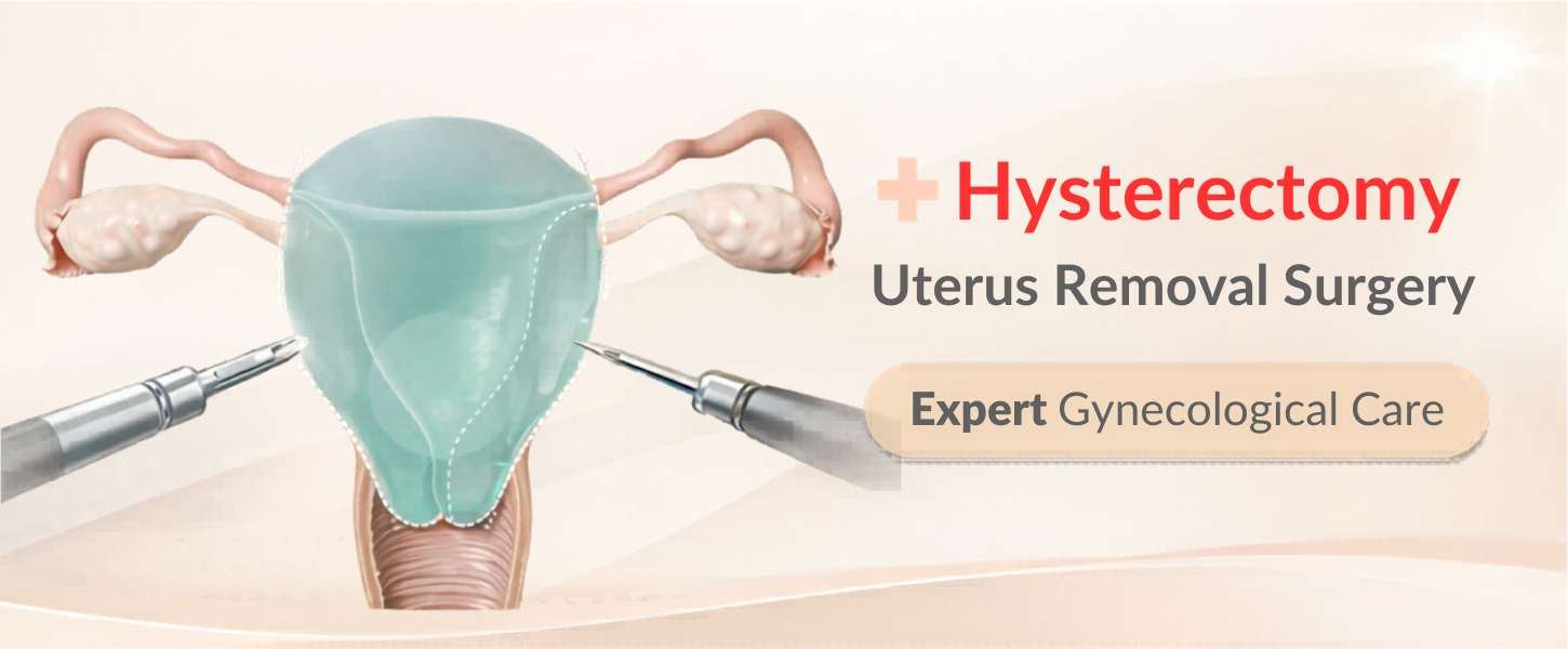 hysterectomy in Sector 47 Gurgaon