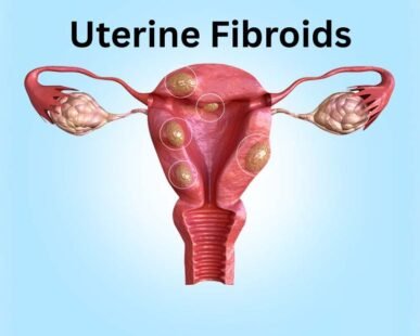 uterine fibroids