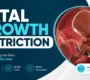 fatal growth restruction 90x80