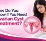 Ovarian Cyst Treatment 90x80