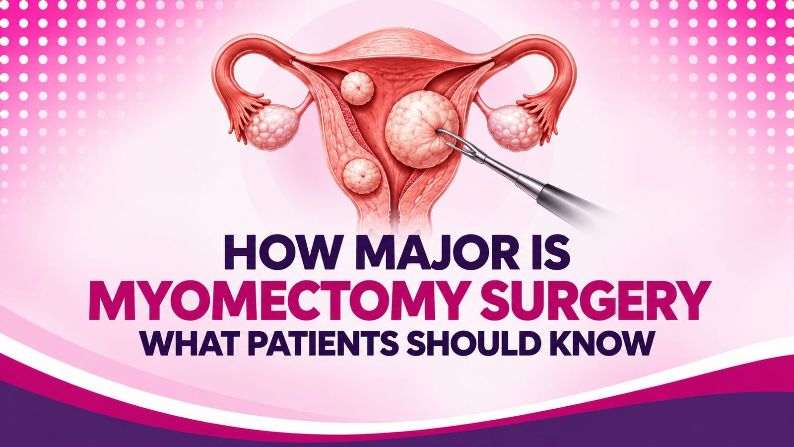 How Major Is Myomectomy Surgery? What Patients Should Know